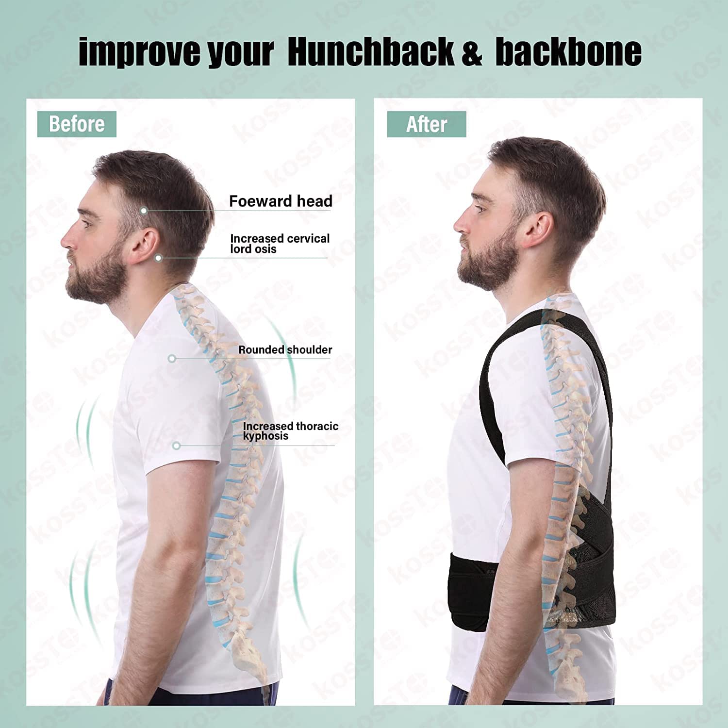 Breath Easy Adjustable Posture Corrector – Comfort & Back Support for Men and Women